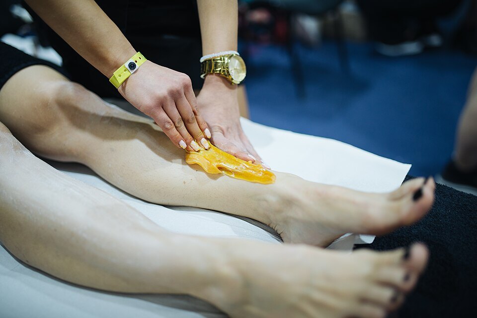 Waxing and sugaring depilation on a woman's legs — the repeat cycle laser hair removal replaces